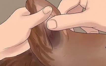 狗狗結石手術后恢復期