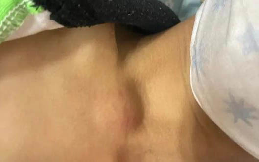 狗狗為什么會吐水水